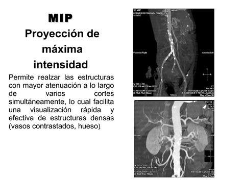 Reconstrucci N En Tc Ppt