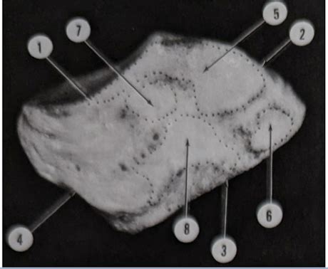 LATERAL SURFACE OF MEDIAL CUNEIFORM Diagram | Quizlet