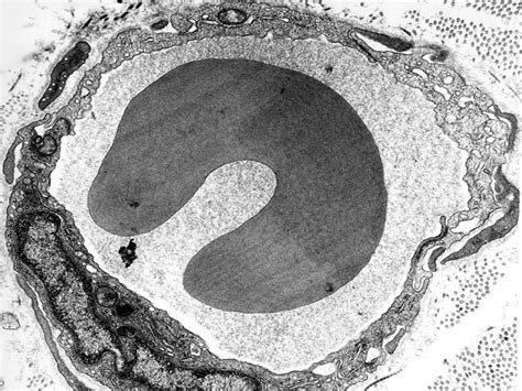 Capillary Histology