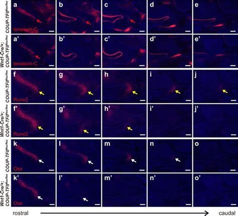 Coup Tfii Is Required For Morphogenesis Of The Neural Crest Derived