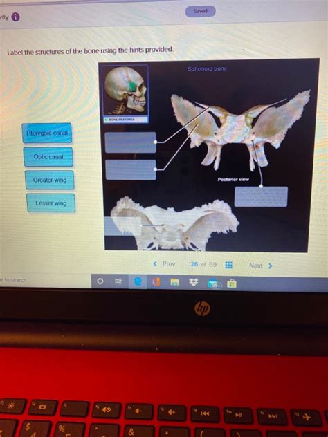 Solved Saved Wity Label The Structures Of The Bone Using The Chegg