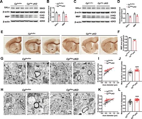 Impairment Of Myelin Formation In The Brain Of Cp Gfap CKO Mice A D