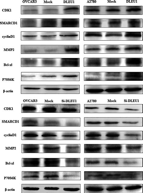 Dleu Contributes To Ovarian Carcinoma Tumourigenesis And Development