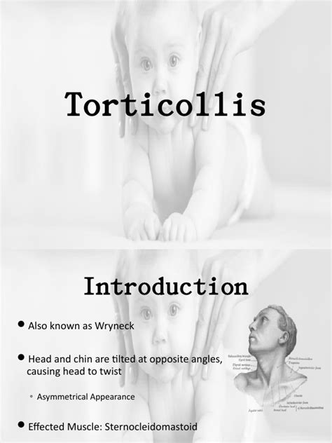 Torticollis Pdf Clinical Medicine Diseases And Disorders