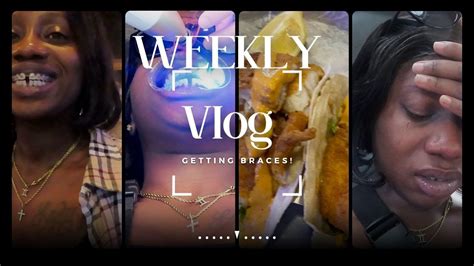 VLOG WEEKLY VLOG GETTING BRACES COME GET BRACES WITH ME YouTube