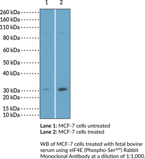 Anti Eif4e Phospho Ser209 Rabbit Monoclonal Antibody Clone Rm452