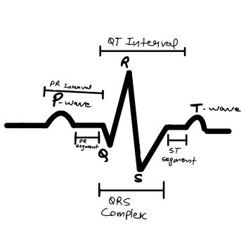 Ecg Waves Labeled Hot Sex Picture