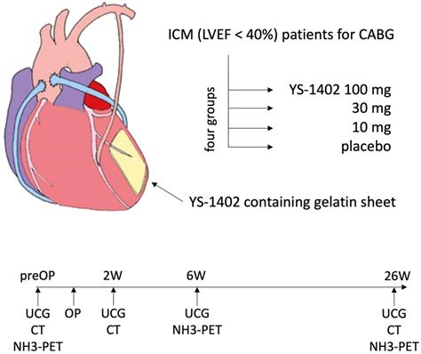 Study Scheme Icm Ischemic Cardiomyopathy Lvef Left Ventricular