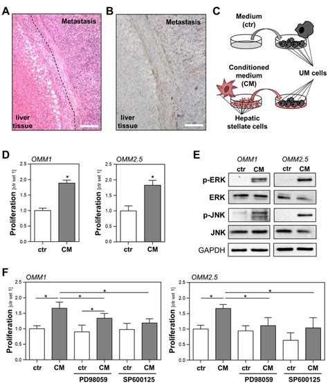 Interaction Of Activated Hepatic Stellate Cells Hscs And Uveal