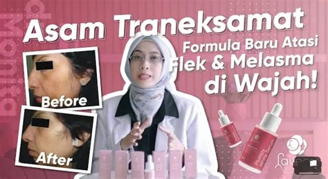 Inilah Skincare Untuk Menghilangkan Flek Hitam Dan Bekas Jerawat Bpom