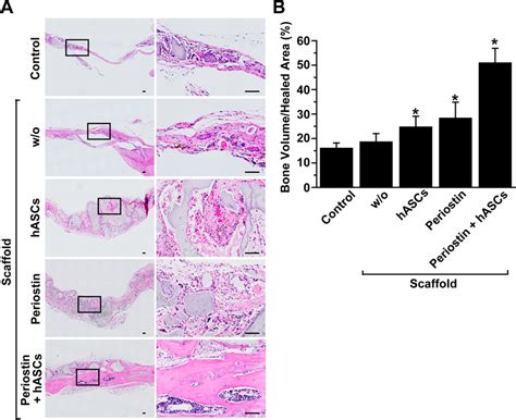 Histological Analysis Of Newly Regenerated Bone After Implantation Of