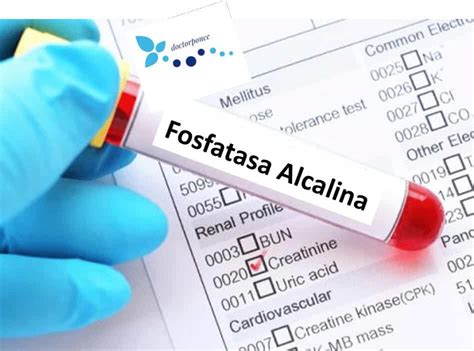 Fosfata Alcalina Qu Indica El Nivel Alto O Bajo Ailin