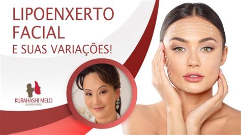 Lipoenxerto Facial e suas variações YouTube