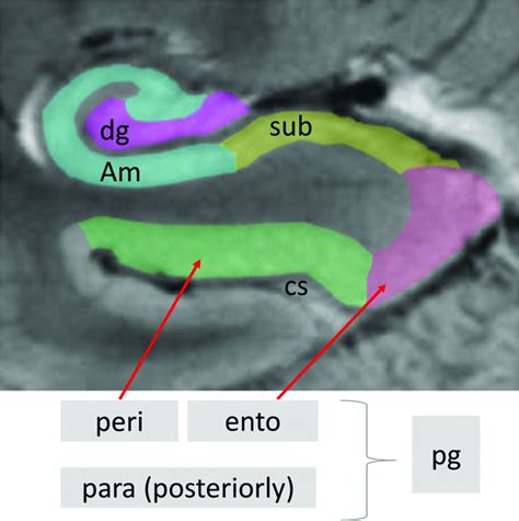 Memory Part 2 The Role Of The Medial Temporal Lobe American Journal