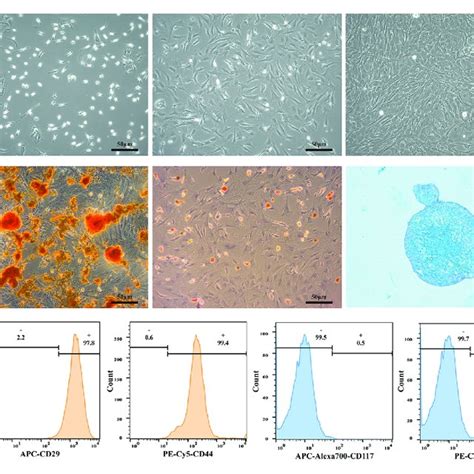 Culture And Phenotype Identification Of Bone Marrow Mesenchymal Stem