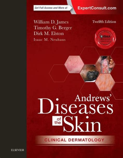 Andrews Diseases Of The Skin Clinical Dermatology Edition By