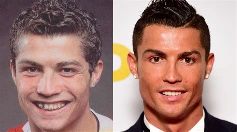 Cristiano Ronaldo And Chirurgie Esthétique Lincroyable Transformation