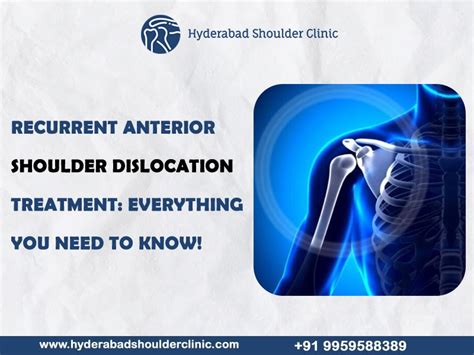 Recurrent Anterior Shoulder Dislocation Treatment Everything You Need