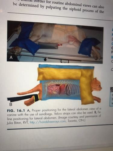 Abdomen And Thorax Flashcards Quizlet