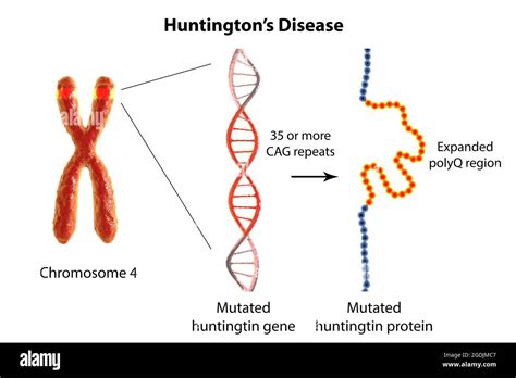 Molecular Genesis Of Huntingtons Disease Hi Res Stock Photography And