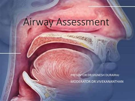 Airway Assessment In Surgery Patients Implications Ppt