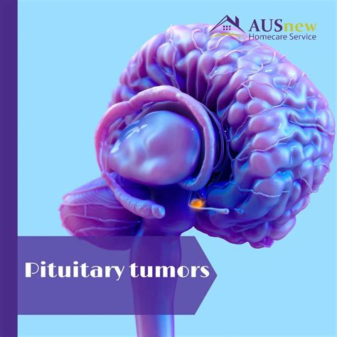 Pituitary tumors symptoms and causes – Artofit