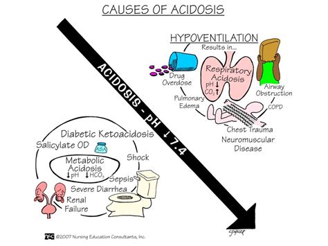 Causes of Acidosis-ABC Medicine