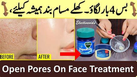 Open Pores On Face Skin Repair Just Time Use Remove Close Large