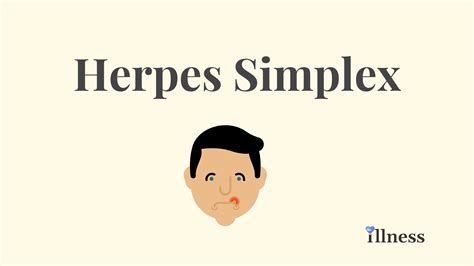 Herpes Simplex : Overview, Causes, Symptoms, Treatment - illness.com