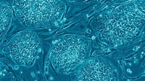 Study Identifies Stem Cells As Cancer Source