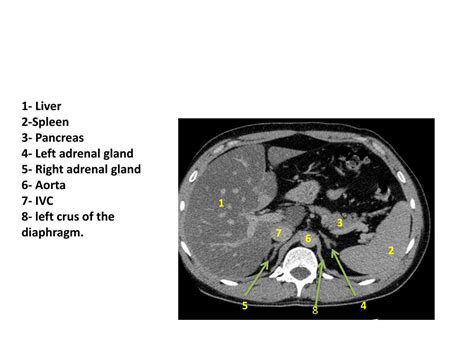 Ppt Adrenal Gland Radiology Powerpoint Presentation Free Download Id2255175