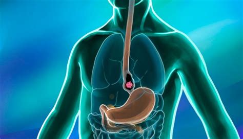 Esophageal cancer: 10 things to know | MD Anderson Cancer Center