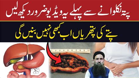 Pity Ki Pathri Ka Ilaj In Urdu Pity Me Dard Ka Ilaj Gallbladder