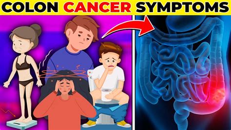 Critical Colon Cancer Signs And Symptoms Colorectal Cancer Symptoms