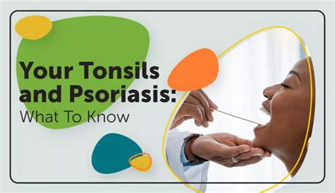 Your Tonsils and Psoriasis: What To Know | MyPsoriasisTeam