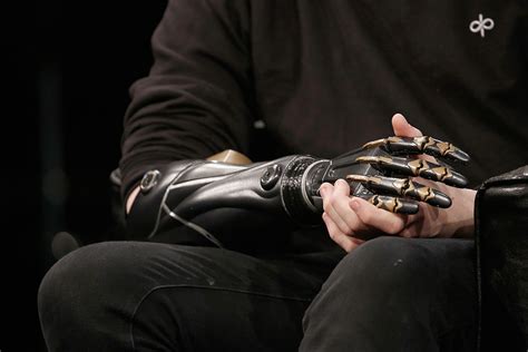 D Printed Prosthetics Student Makes Functioning Plastic Hand For Just