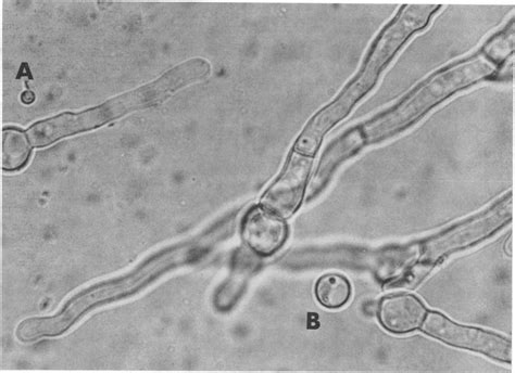 Aspergillus Slide Labeled