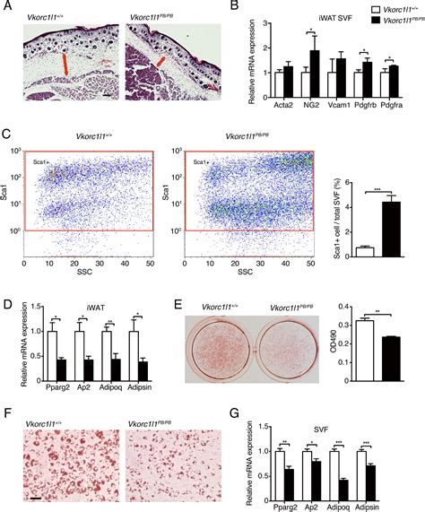 The Vitamin K Epoxide Reductase Vkorc L Promotes Preadipocyte