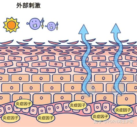 什么是皮肤屏障？ 知乎