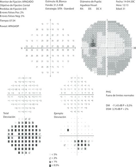 Campo Visual 30 2 De Ojo Izquierdo En El Que Se Aprecia La Reducción