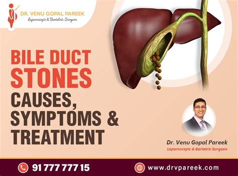 Bile Duct Stones - Causes, Symptoms and Treatment