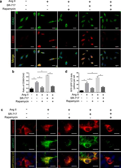 Impaired Autophagic Flux Induced By CGAS STING Activation Contributed