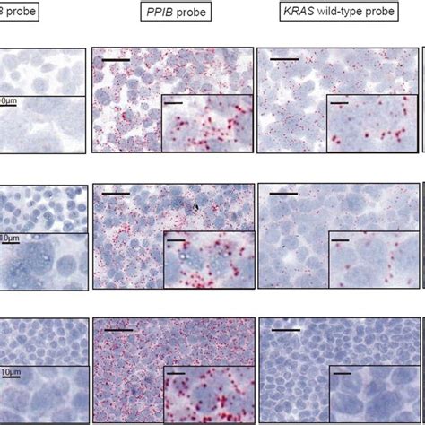 Rna‐based In Situ Hybridization Assay In Ovarian Cancer Cell Lines