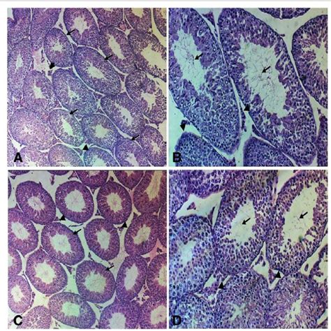 Photomicrograph Of The Testis Section Stained With Hematoxylin And