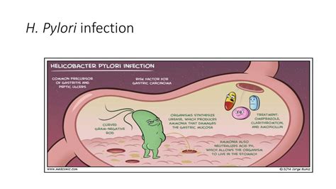 Antibiotics To Treat H Pylori Bacteria