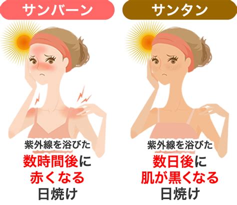 日焼けしやすいタイプ？しにくいタイプ？それぞれの特徴 オトナ女子