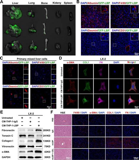 Gc Derived Lbp Are Mainly Accumulated In The Liver And Colocalized With