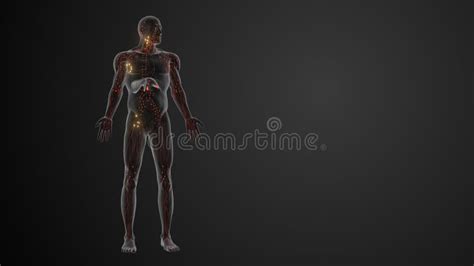 Prognosis and Staging of Lymphoma Stock Photo - Image of illness ...