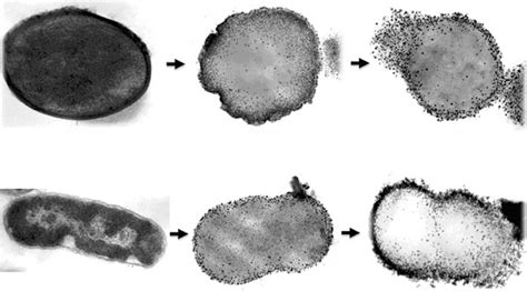 TEM Images Of The Morphological Changes In Bacterial Cells Under The