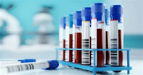 Researchers Develop Simple Blood Tests To Quickly Recognise Sarcoidosis